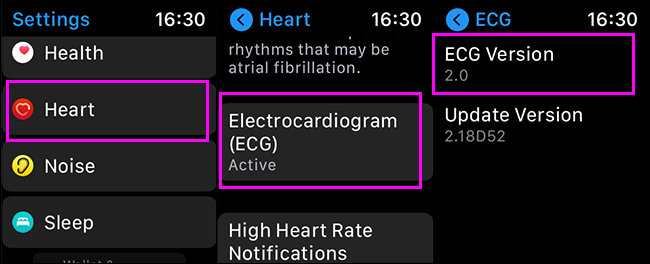 Comprobación de la versión de ecg en el Apple Watch