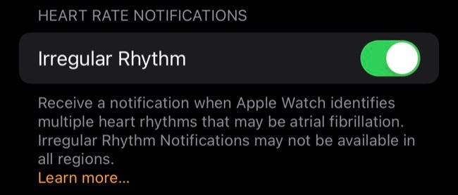 Notificaciones de ritmo irregular en Apple Watch