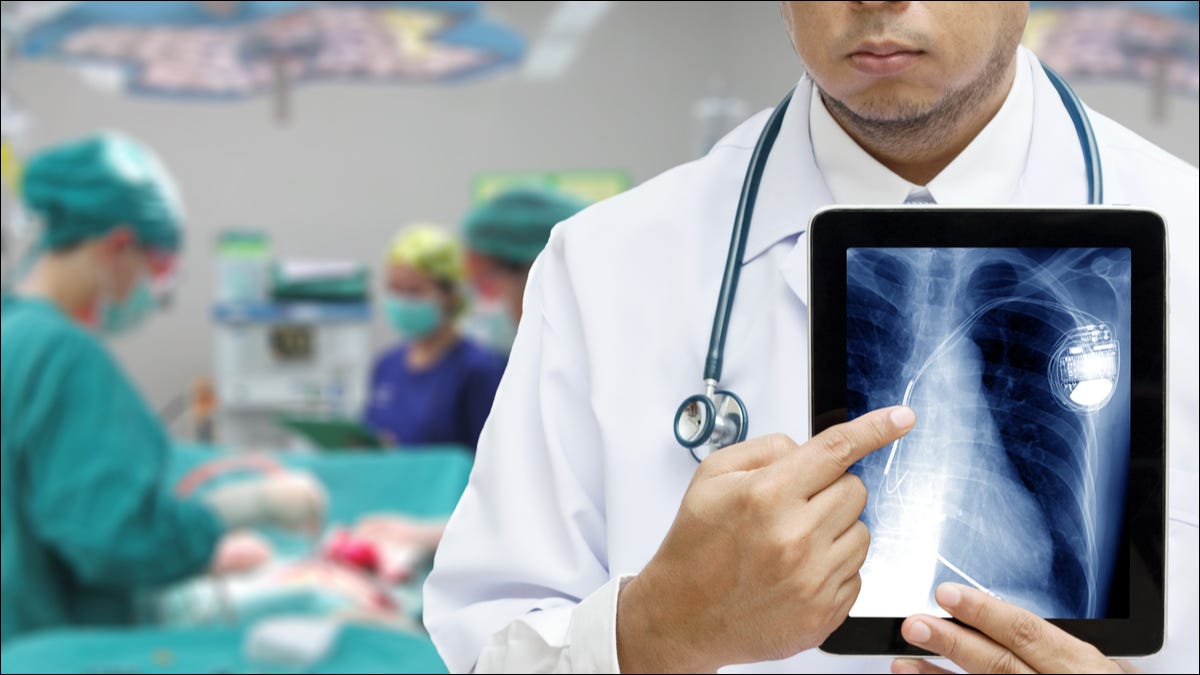 Un médico apuntando a un implante de marcapasos en un iPad